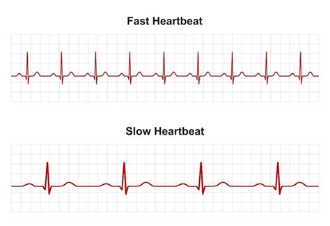 ekg test is hard|abnormal ekg heart rate.